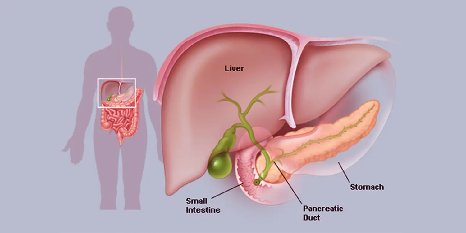 pancreas stone treatment